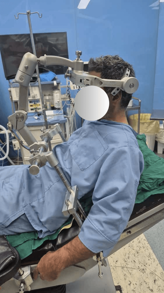 SteadySkull in operating room