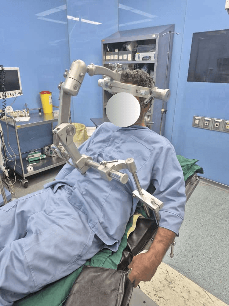 SteadySkull clinical use